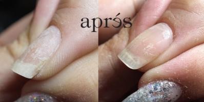 Gel-X Repair on Cracked Natural Nail